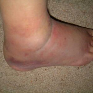 Foot 1.jpg