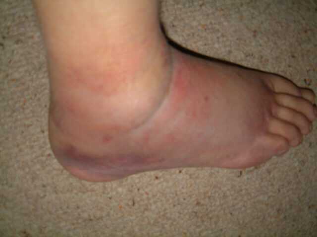 Foot 1.jpg