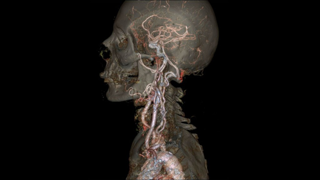 GE CT Scanner.jpg