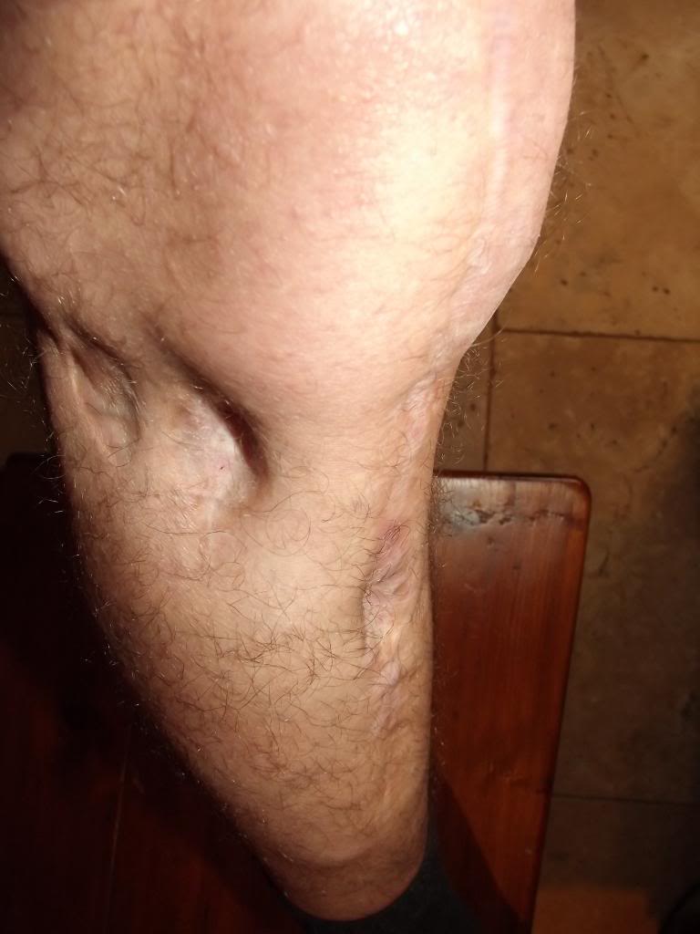 leg002_zps3e1f8fb6.jpg