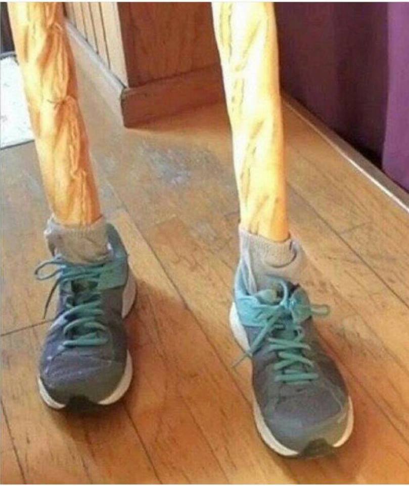 pain in the legs.jpg